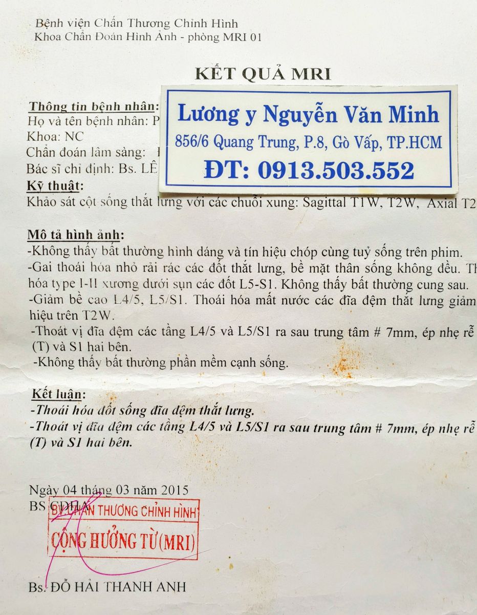 Thoát vị đĩa đệm có chữa được không